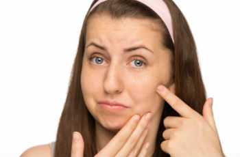 Прыщи на щеках у женщин: причины появления и способы лечения