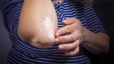 Неожиданные причины кожных заболеваний